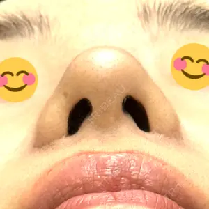 口コミ