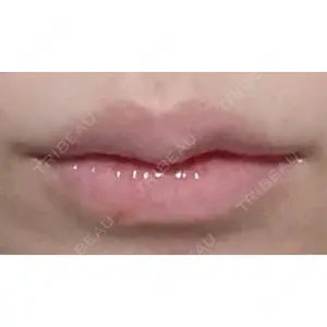 オーキッド美容クリニック東京御徒町口コミ
