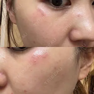 APスキンクリニック銀座口コミ