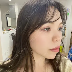 HAAB CLINIC HAAB×DREAM BEAUTY CLINIC 大阪梅田院口コミ
