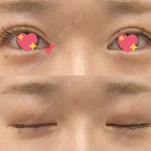 口コミ