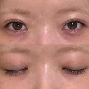 コスメディカルクリニック シンシア コスメディカルクリニック シンシア 銀座院口コミ