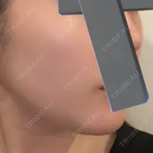 口コミ