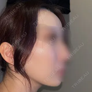 BISIN GINZA CLINIC口コミ