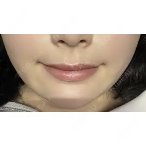 口コミ
