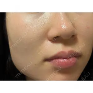 Belle Via Clinic Belle Via Clinic口コミ
