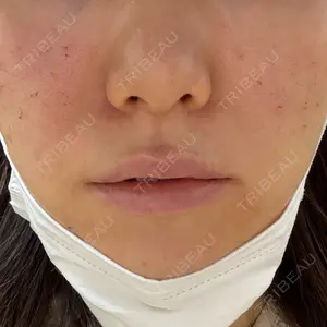 ルラ美容クリニック ルラ美容クリニック 新潟院口コミ