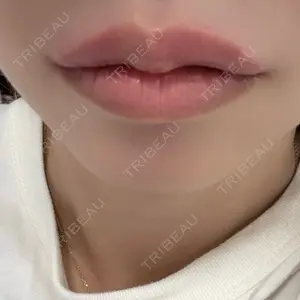 口コミ