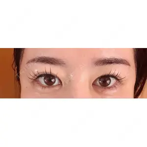 口コミ