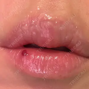 口コミ