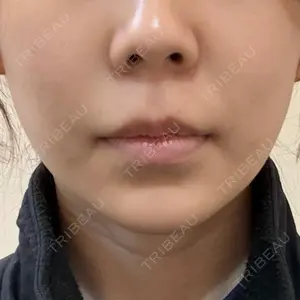 口コミ