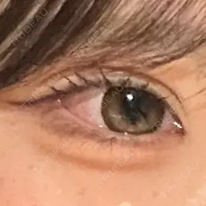 口コミ