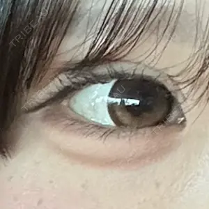 口コミ