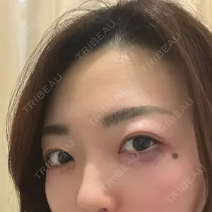 口コミ