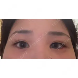 TCB東京中央美容外科 TCB東京中央美容外科 和歌山院口コミ