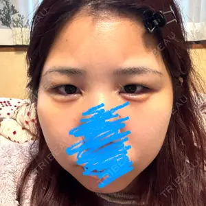 TCB東京中央美容外科 TCB東京中央美容外科 和歌山院口コミ