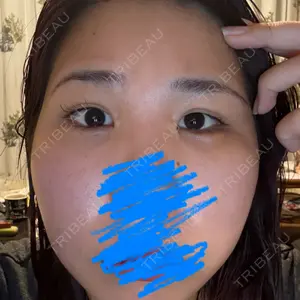 TCB東京中央美容外科 TCB東京中央美容外科 和歌山院口コミ