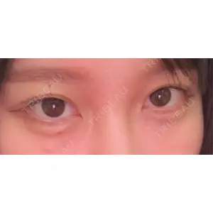 口コミ