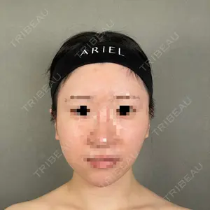 アリエル美容クリニック アリエル美容クリニック 大宮院口コミ