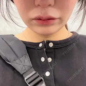 HAAB BEAUTY CLINIC 南青山本院（新院）口コミ