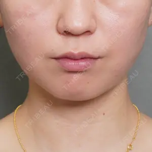 アリエル美容クリニック アリエル美容クリニック 大宮院口コミ