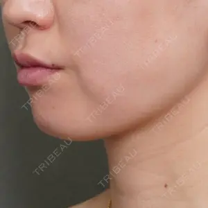 アリエル美容クリニック アリエル美容クリニック 大宮院口コミ