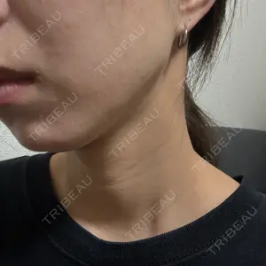 Belle Via Clinicの