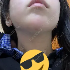 口コミ