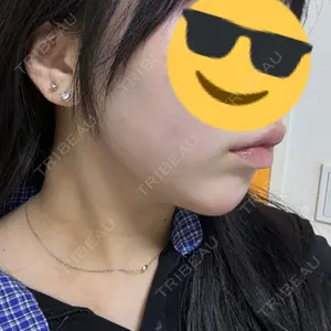 口コミ