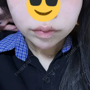 口コミ