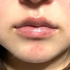 ルラ美容クリニック ルラ美容クリニック 岐阜院口コミ