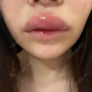 プロクリニック PRO CLINIC プロクリニック 銀座院口コミ