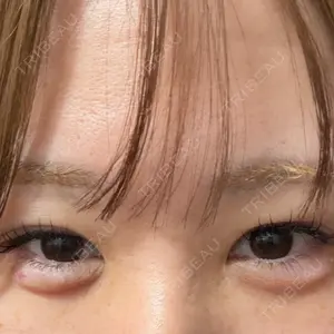 HAAB CLINIC HAAB×DREAM BEAUTY CLINIC 大阪梅田院口コミ