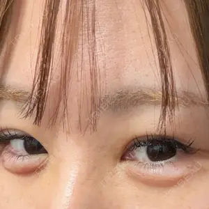 HAAB CLINIC HAAB×DREAM BEAUTY CLINIC 大阪梅田院口コミ