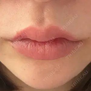 HAAB CLINIC HAAB×DREAM BEAUTY CLINIC 大阪梅田院口コミ