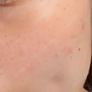 銀座CherijeClinic 銀座CherijeClinic口コミ