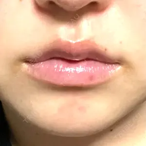 ルラ美容クリニック ルラ美容クリニック 岐阜院口コミ
