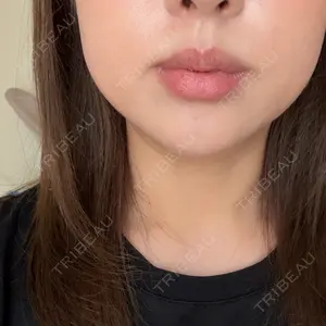 口コミ