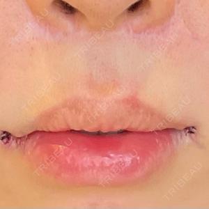 LOUIS CLINIC 二子玉川院【ルイクリニック】口コミ
