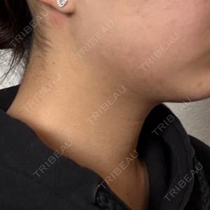 ARTE BEAUTY CLINIC口コミ