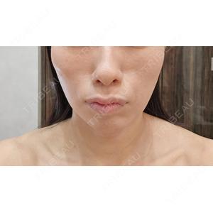WOM CLINIC WOM SALON【術後ケア取扱いサロン】口コミ