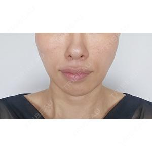 WOM CLINIC WOM SALON【術後ケア取扱いサロン】口コミ