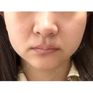 口コミ