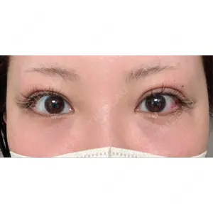 東京シンデレラ美容外科 東京シンデレラ美容外科 池袋院口コミ