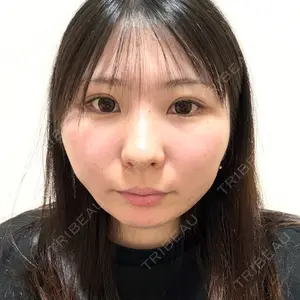 4Dクリニック口コミ