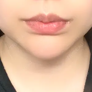 口コミ