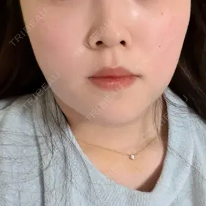 HAAB CLINIC HAAB×DREAM BEAUTY CLINIC 東京本院口コミ