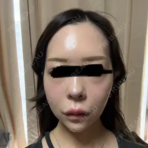 Nebula Clinic 札幌美容外科ネビュラクリニック口コミ