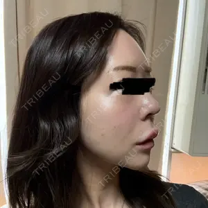 Nebula Clinic 札幌美容外科ネビュラクリニック口コミ