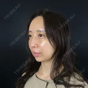 藤・ナチュレ美容クリニック 藤・ナチュレ美容クリニック 銀座院口コミ